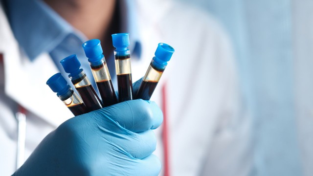 bai-viet/xet-nghiem-sat-huyet-thanh-va-ferritin-vai-tro-khoang-tham-chieu-va-luu-y-truoc-khi-thuc-hien.html