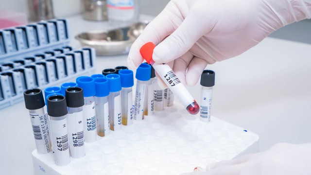 bai-viet/xet-nghiem-xo-gan-co-can-thiet-khong-71761.html