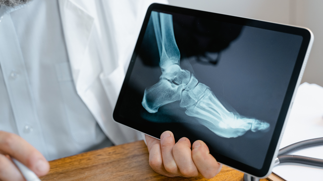 benh/xo-cung-xuong.html