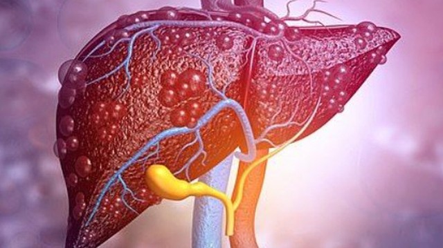 bai-viet/xo-gan-do-ruou-co-chua-khoi-hoan-toan-duoc-khong-71836.html