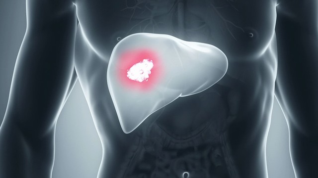 bai-viet/xo-gan-f2-la-gi-xo-gan-f2-song-duoc-bao-lau-71837.html