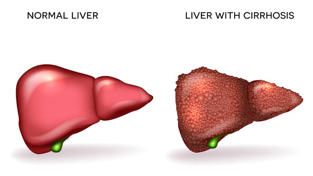 benh/xo-gan-mat-bu.html