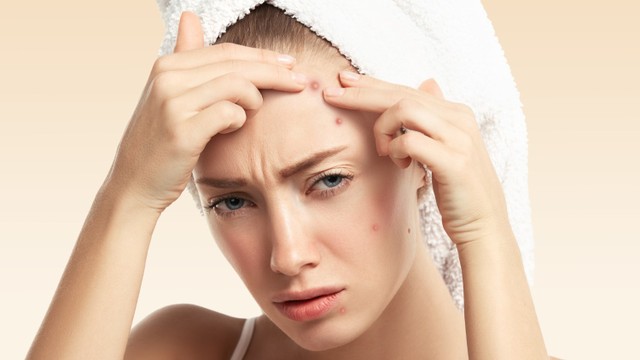 bai-viet/xoa-tan-noi-lo-ve-mun-mu-voi-derma-angel.html