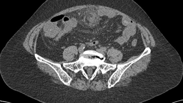 bai-viet/xoan-mac-noi-lon-trieu-chung-nguyen-nhan-va-cach-dieu-tri.html