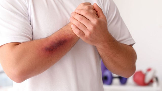 bai-viet/xuat-huyet-giam-tieu-cau-nen-an-gi-nhung-luu-y-can-biet.html