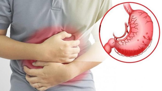 bai-viet/nhung-dieu-can-biet-ve-xuat-huyet-niem-mac-da-day.html