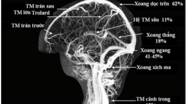 bai-viet/y-nghia-cua-chup-mra-cong-huong-tu-mach-mau-65455.html
