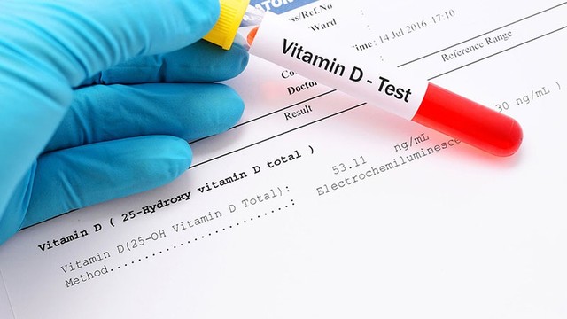 bai-viet/y-nghia-cua-xet-nghiem-vitamin-d-la-gi-vai-tro-cua-vitamin-d-doi-voi-co-the.html