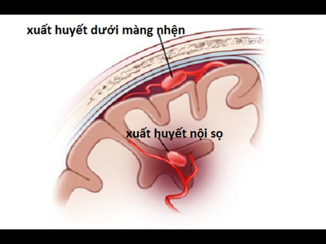 benh/xuat-huyet-duoi-nhen-1038.html