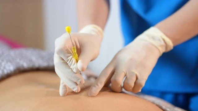 bai-viet/10-trieu-chung-sau-khi-cay-chi-co-the-gap-phai-ma-ban-nen-biet.html