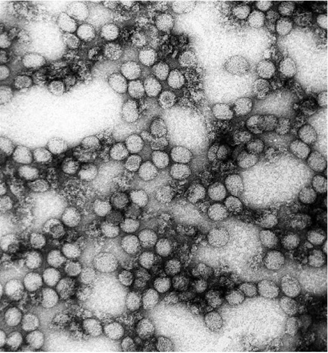 benh/sot-vang-156.html