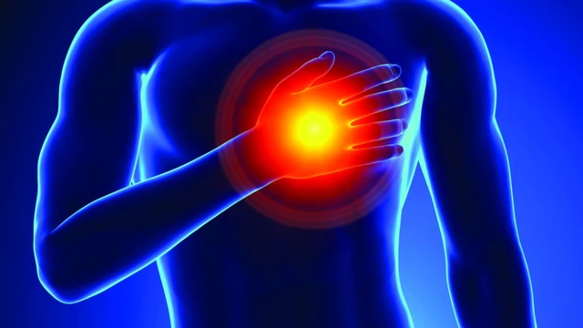 Nhồi máu cơ tim cấp là gì? Những điều cần biết về bệnh nhồi máu cơ tim cấp 1