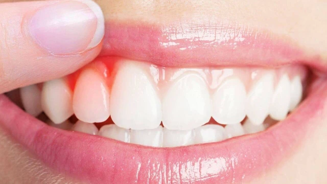 bai-viet/nuou-la-gi-cau-tao-va-chuc-nang-cua-nuou.html