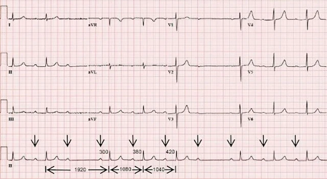 benh/block-nhi-that-224.html