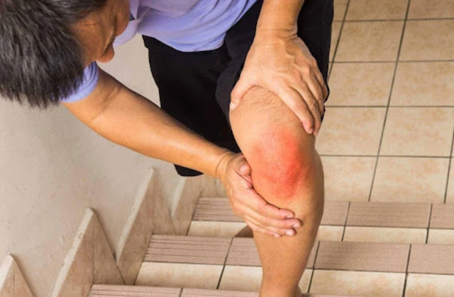 benh/viem-khop-phan-ung-256.html