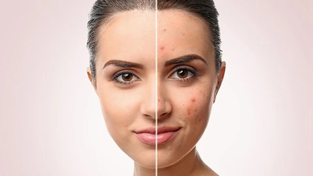 bai-viet/vitamin-c-co-tri-tham-khong-tac-dung-cua-vitamin-c-voi-lan-da.html