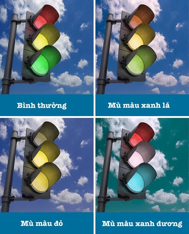 benh/mu-mau-396.html