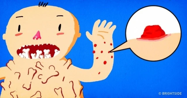 bai-viet/3-dau-hieu-bi-di-ung-quan-trong-thuong-gap-ma-ban-nen-biet-11904.html