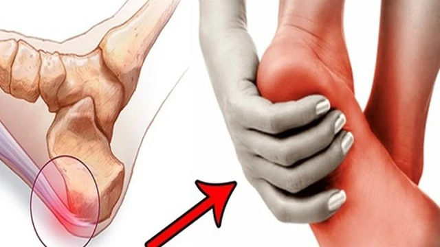 bai-viet/3-loai-thuoc-dac-tri-viem-can-gan-chan-va-cach-phong-ngua-56651.html