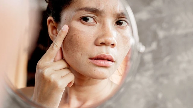 bai-viet/4-thanh-phan-ban-nhat-dinh-phai-bo-sung-neu-muon-lam-cham-qua-trinh-lao-hoa-da-51227.html