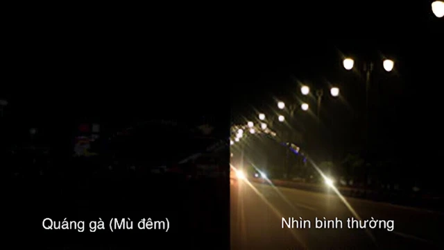 benh/quang-ga-551.html