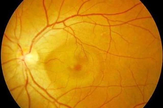 benh/tac-dong-mach-vong-mac-trung-tam-552.html