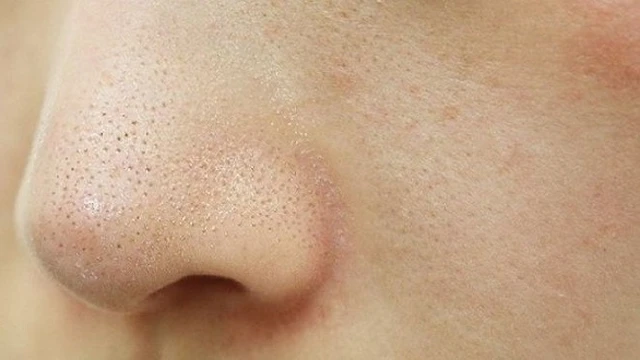 bai-viet/5-cach-lam-sach-soi-ba-nhon-hai-ben-ma-don-gian-tai-nha-67538.html