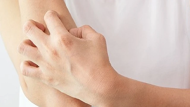 bai-viet/5-cach-lam-seo-loi-het-ngua-hieu-qua-54238.html