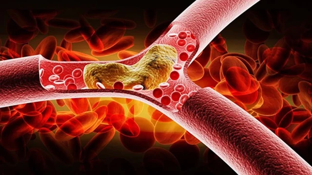 bai-viet/5-nguyen-nhan-khong-the-ha-mo-mau-ban-nen-biet.html