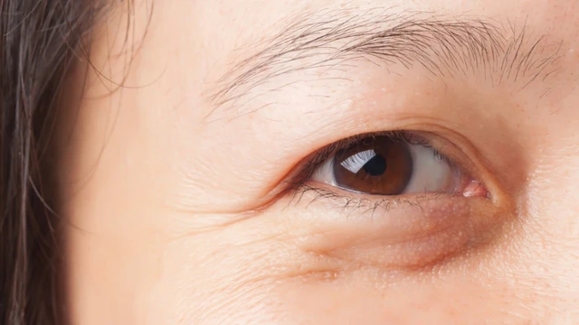 bai-viet/5-sai-lam-khi-duong-mat-lam-lo-ro-cac-nep-nhan-va-nhanh-lao-hoa.html