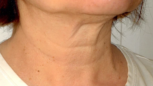 bai-viet/6-cach-lam-cham-qua-trinh-lao-hoa-da-vung-co-52486.html