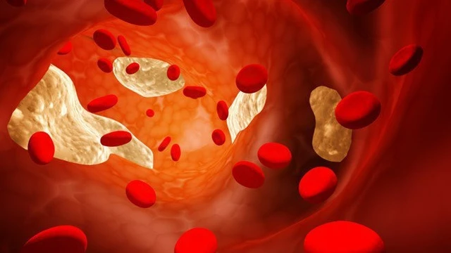 bai-viet/8-cach-giup-ban-giam-cholesterol-mau-62158.html