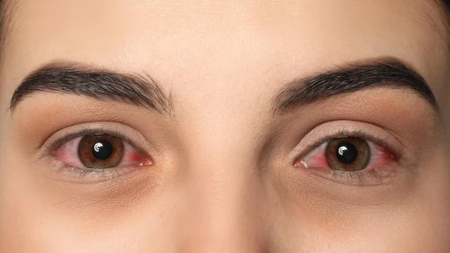 bai-viet/9-cach-phong-benh-dau-mat-do-hieu-qua-ai-cung-nen-biet.html