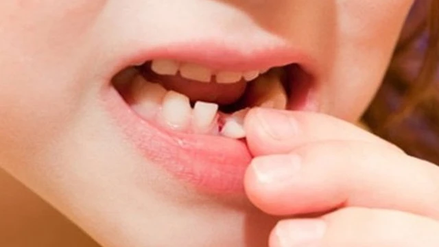 bai-viet/be-bi-nga-lung-lay-rang-sua-phu-huynh-nen-lam-gi.html