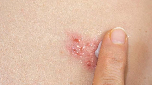 bai-viet/cach-tri-gioi-leo-tai-nha-an-toan-va-hieu-qua-khong-de-lai-seo.html