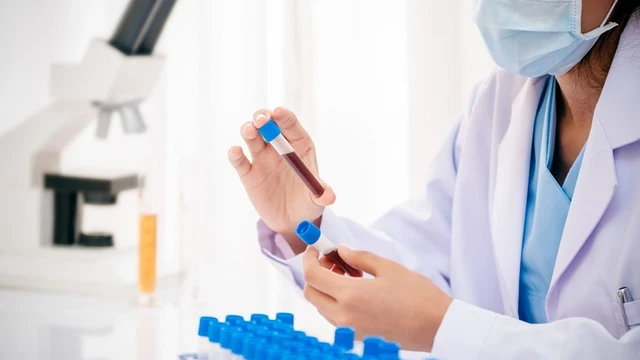 bai-viet/chay-mau-lau-cam-nguyen-nhan-va-cach-xu-ly-hieu-qua.html