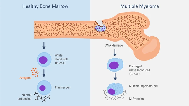 benh/da-u-tuy-xuong.html