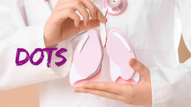 bai-viet/dots-la-gi-vai-tro-cua-chien-luoc-dots-trong-kiem-soat-va-dieu-tri-benh-lao.html
