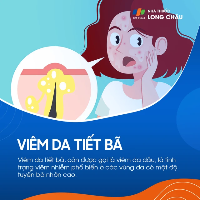 Viêm da tiết bã: Nguyên nhân và cách điều trị hiệu quả