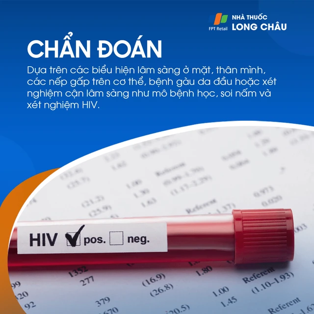 Viêm da tiết bã: Nguyên nhân và cách điều trị hiệu quả