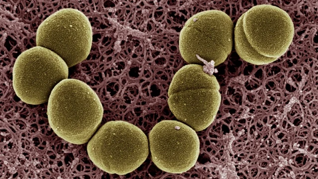 bai-viet/enterococcus-faecalis-vi-khuan-vua-co-loi-vua-co-hai-trong-co-the-nguoi.html