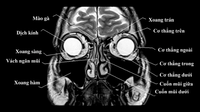 bai-viet/giai-phau-hoc-mat-cau-truc-ben-trong-hoc-mat.html