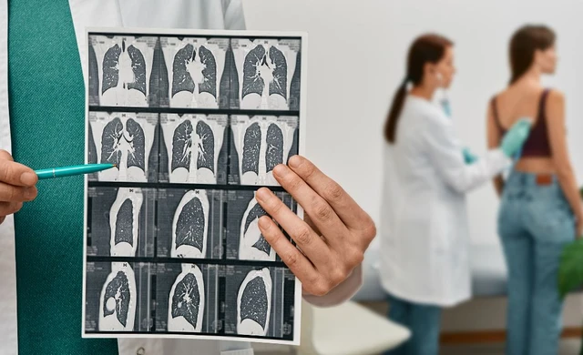 bai-viet/halo-sign-la-gi-tam-quan-trong-cua-dau-hieu-halo-sign-trong-y-khoa.html