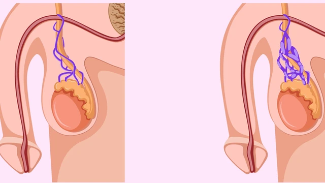 bai-viet/mo-gian-tinh-mach-thung-tinh-bao-lau-co-con-ty-le-mang-thai-tu-nhien-cao-hay-thap.html