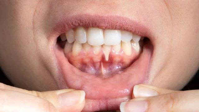 bai-viet/tim-hieu-cac-nguyen-nhan-chay-mau-chan-rang.html