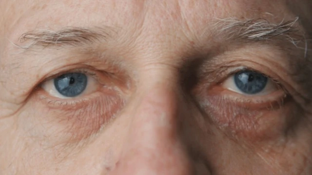 bai-viet/nhung-nguyen-nhan-tang-nhan-ap-ma-ban-can-luu-y.html