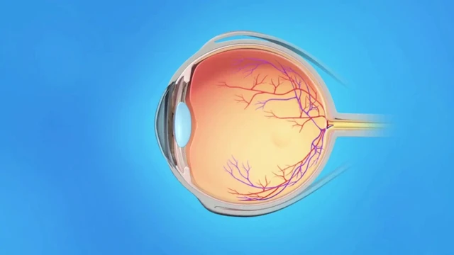 bai-viet/phu-vong-mac-la-gi-bieu-hien-nguyen-nhan-va-giai-phap.html