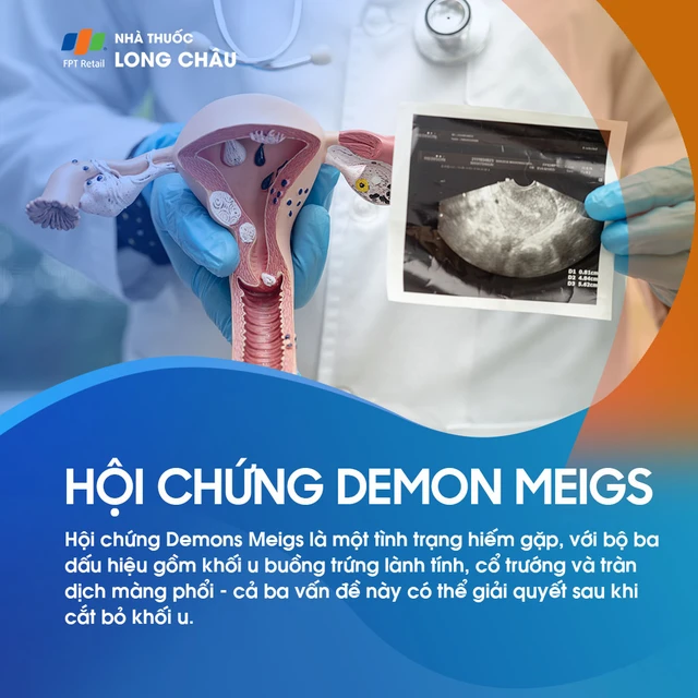 Hội chứng Demons Meigs là gì? Nguyên nhân, triệu chứng và cách điều trị