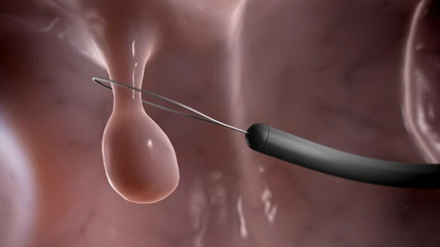 bai-viet/sinh-thiet-truc-trang-va-nhung-dieu-can-biet.html