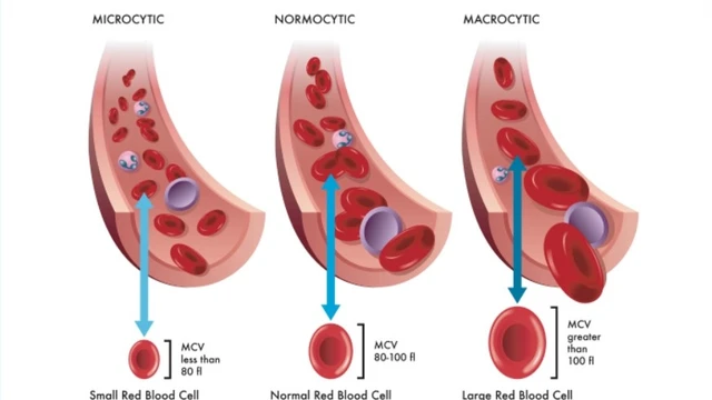 bai-viet/y-nghia-cua-chi-so-the-tich-trung-binh-hong-cau-trong-xet-nghiem-mau.html